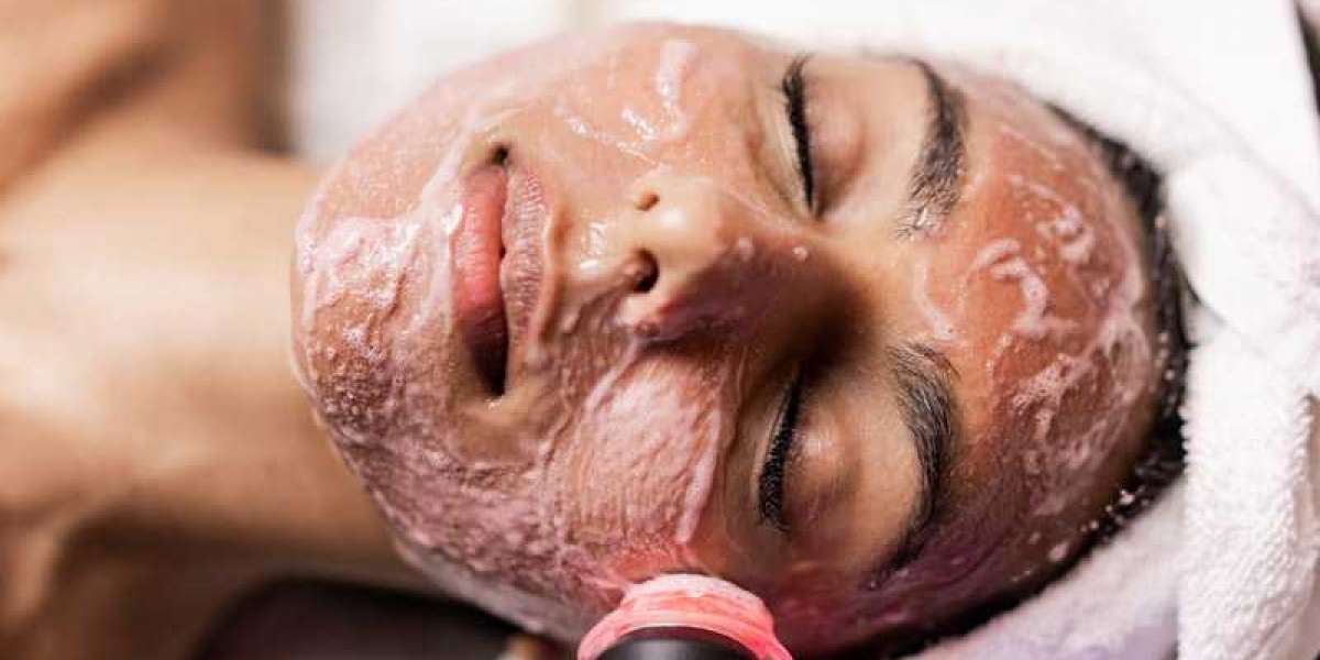 Get the Super OxyGeneo Treatment at Revive Beauty Solutions