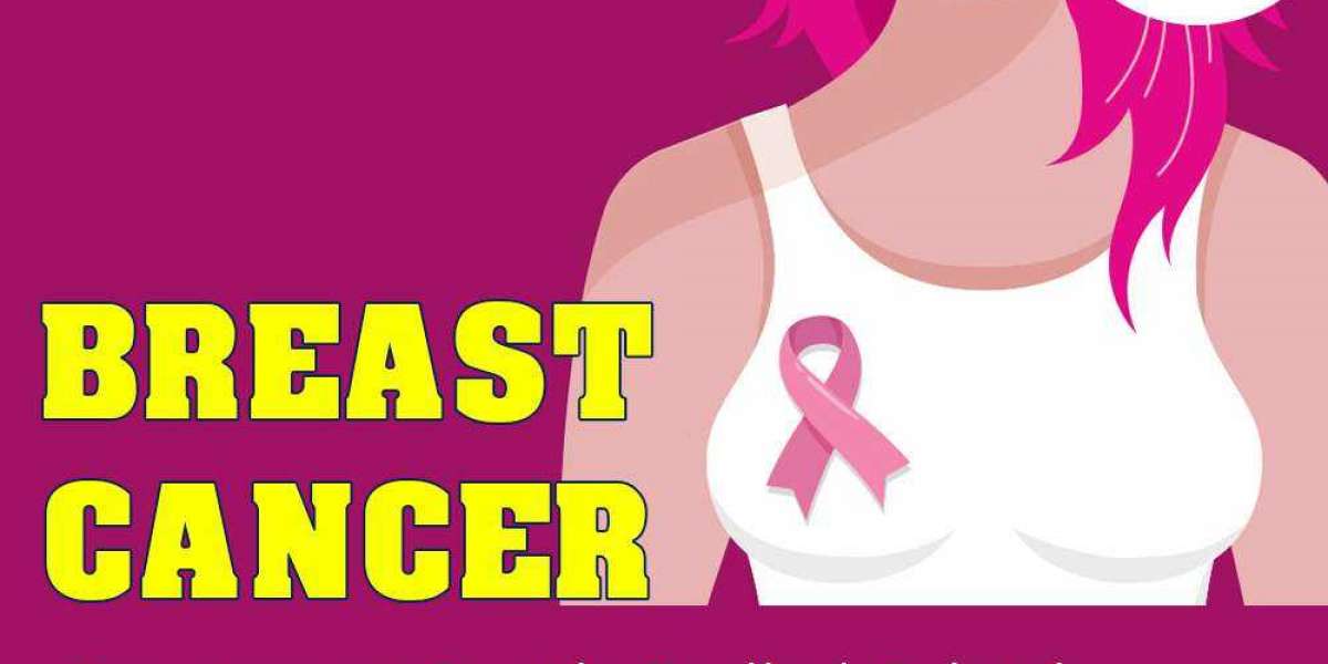 Breast Cancer Surgery Options in India: Mastectomy vs. Lumpectomy