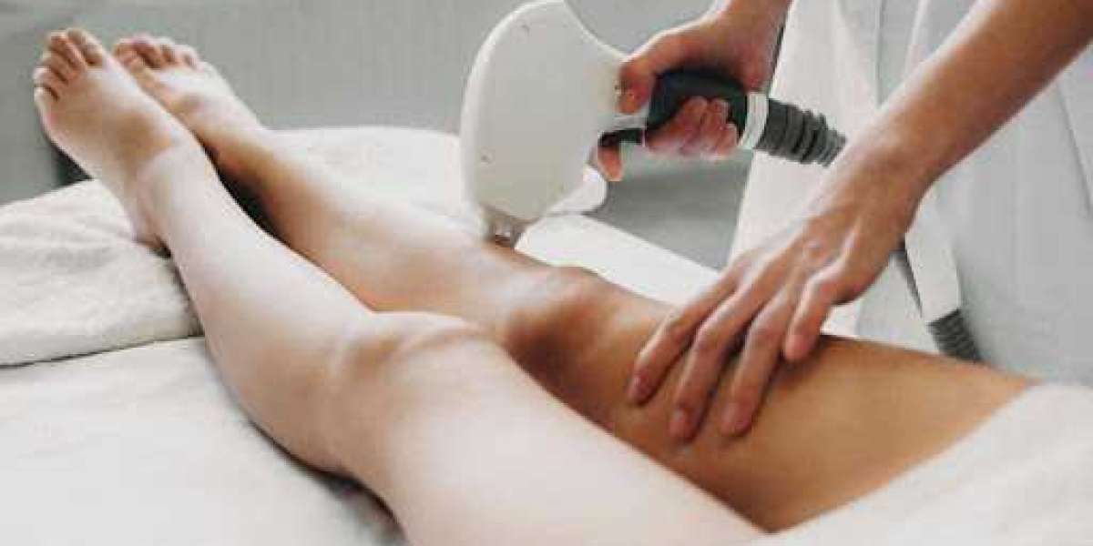 Why Choose Laser Hair Removal at Queen Aesthetics?