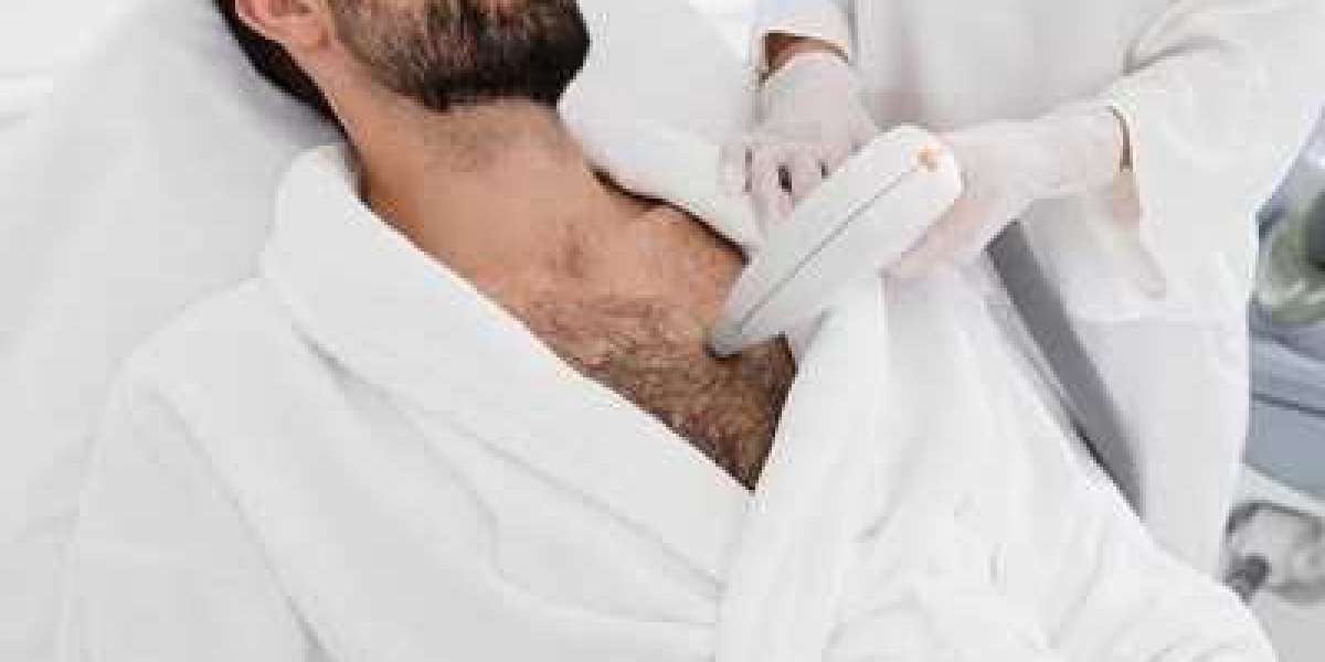 Why Choose Laser Hair Removal in Islamabad?